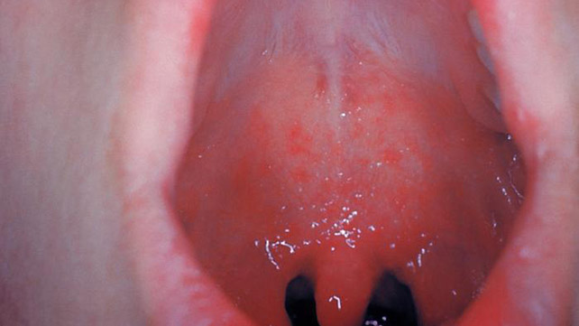 как выглядит кори 