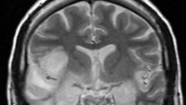 как выглядит кори 