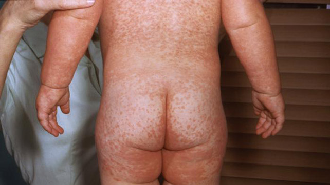 как выглядит кори 