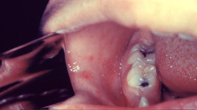 как выглядит кори 