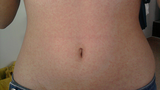 как выглядит кори 