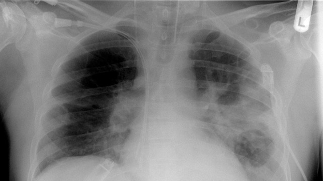 как выглядит кори 